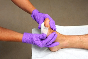How Diabetic Foot Ulcers Impact Quality of Life