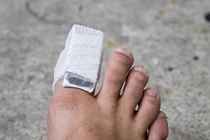 Broken Toes and Buddy Taping