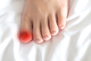 When an Ingrown Toenail Turns Into Infection